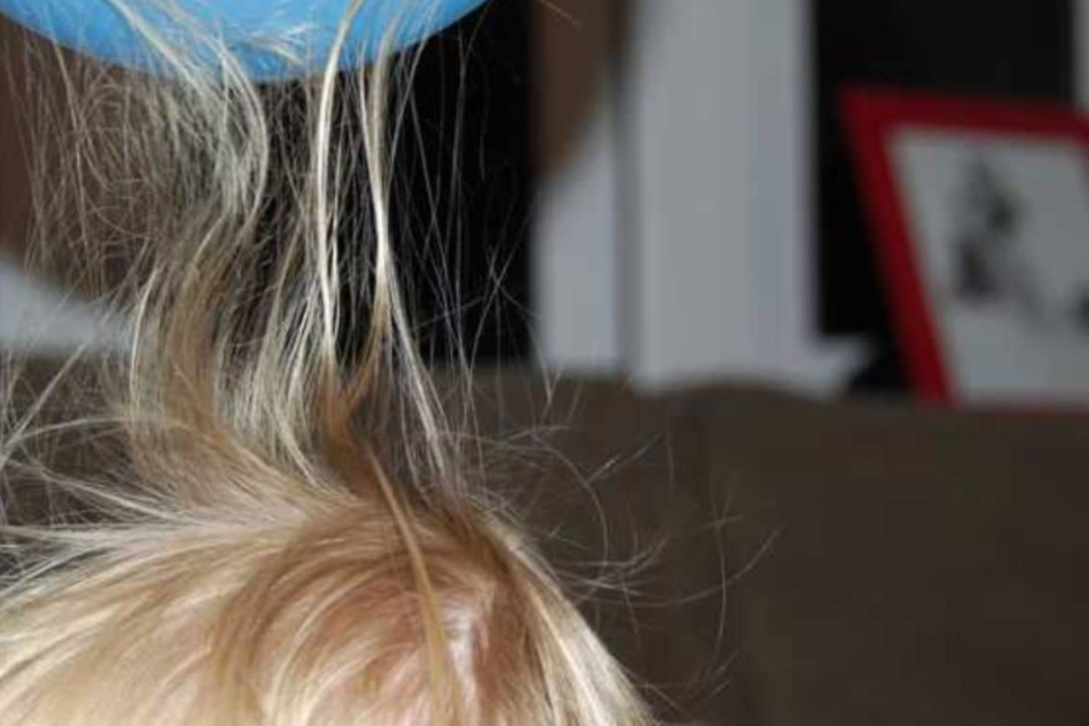 Problem naelektrisane kose tokom zime