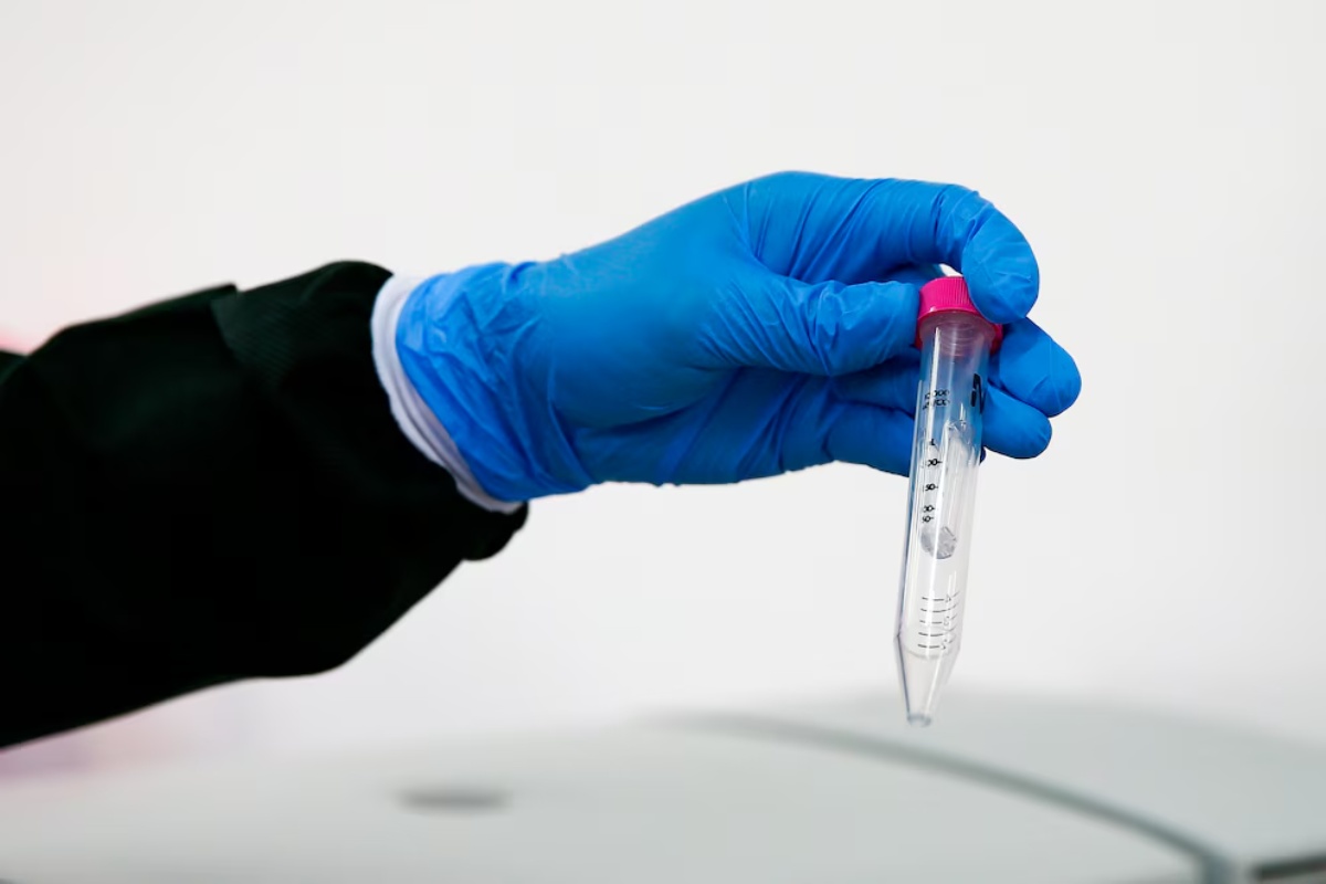 Formiranje ciste kod ameba radi preživljavanja