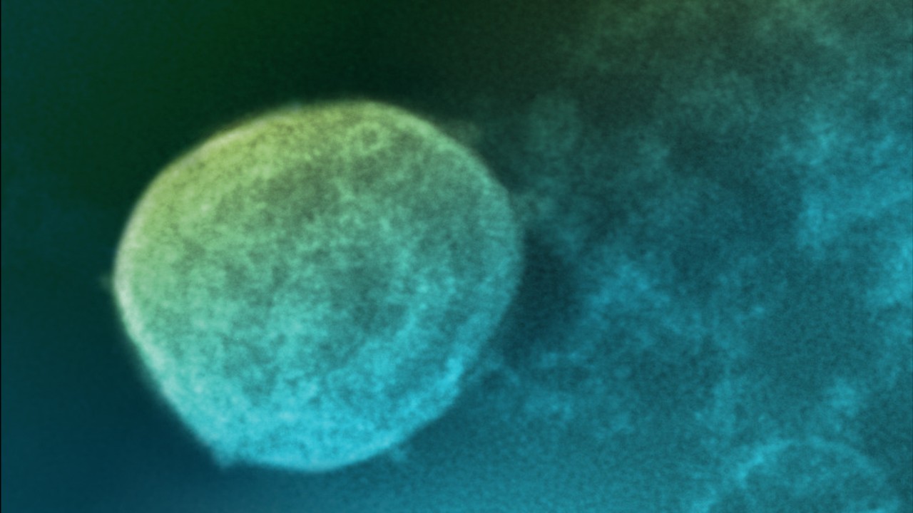 Mapa širenja virusa Nipah u azijskom regionu