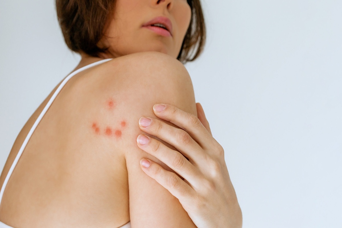 Ležište stjenica u domovima