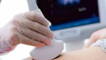 Broj dece i starost majke tokom trudnoće utiču na dugovečnost žena