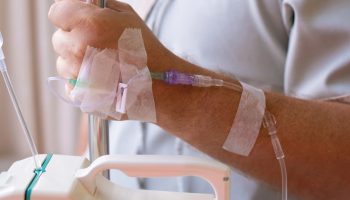 U Rusiji uklonjen tumor teži od 60 kilograma čoveku koji je sa njim živeo dve decenije a da to nije ni primetio: "Trčao sam i radio kao i uvek"