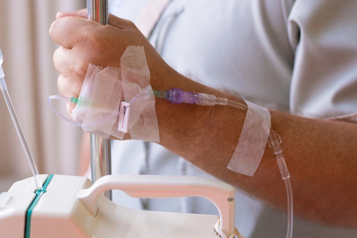 U Rusiji uklonjen tumor teži od 60 kilograma čoveku koji je sa njim živeo dve decenije a da to nije ni primetio: "Trčao sam i radio kao i uvek"