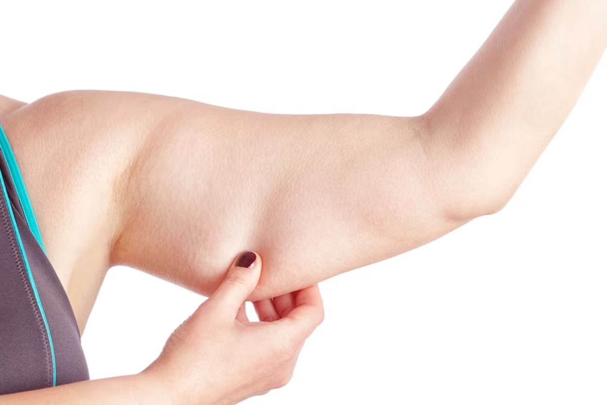 Bež mast: šta je to i njena veza sa arterijskom hipertenzijom