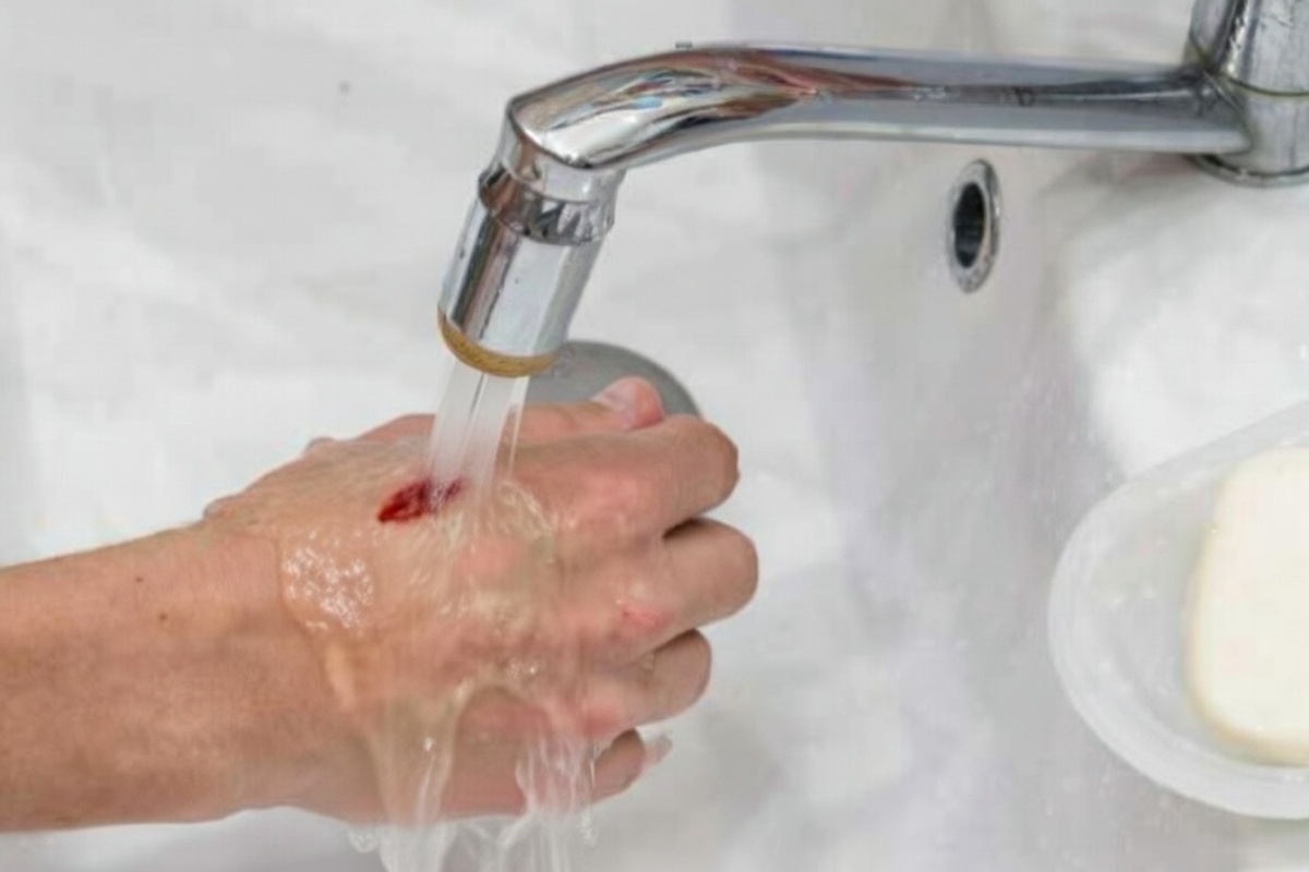 Nije sirće: koji je najbolji način za uklanjanje kamenca sa slavina