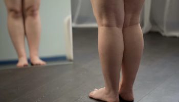 Osobe sa gojaznošću imaju veći rizik od demencije, a ovo je objašnjenje