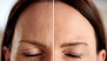 Ova krema je "dizalica" za spuštene kapke. Podiže, zateže i vidno podmlađuje