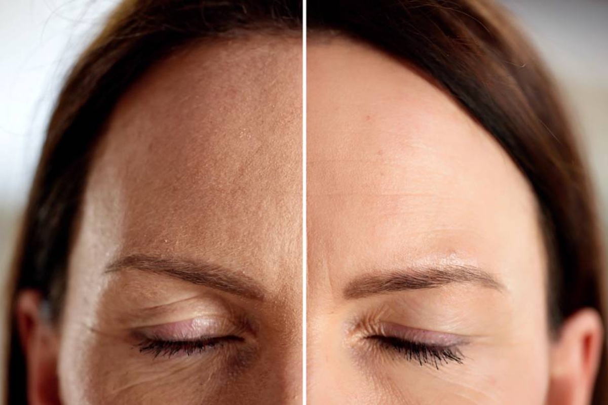 Ova krema je "dizalica" za spuštene kapke. Podiže, zateže i vidno podmlađuje