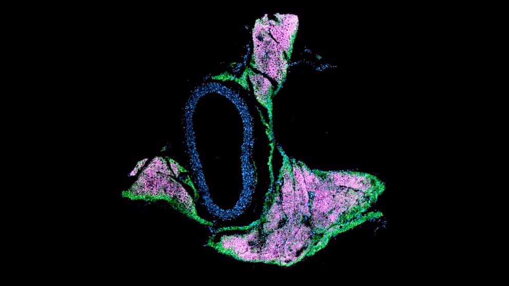 Bež mast: šta je to i njena veza sa arterijskom hipertenzijom – image 1