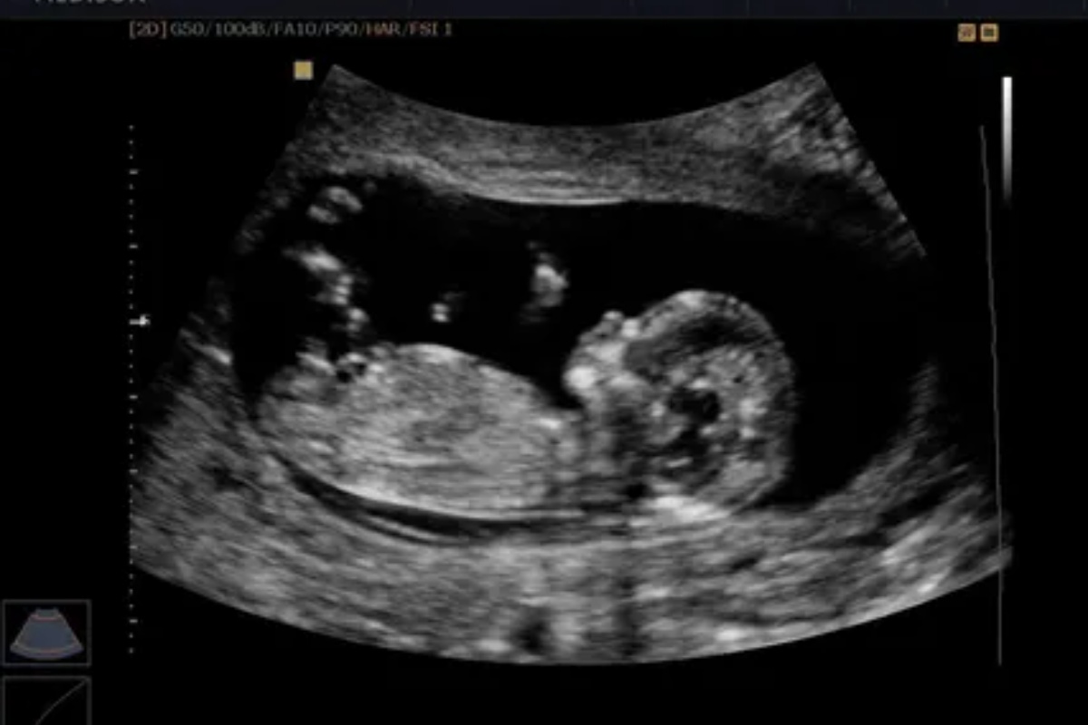 Broj dece i starost majke tokom trudnoće utiču na dugovečnost žena – image 2