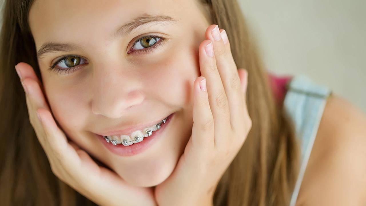 „Epidemija krivih zubi“: većina djece i mladih treba ortodontsko liječenje.