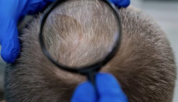 Japansko otkriće: Zašto sijeda kosa može biti znak da vaše tijelo radi savršeno