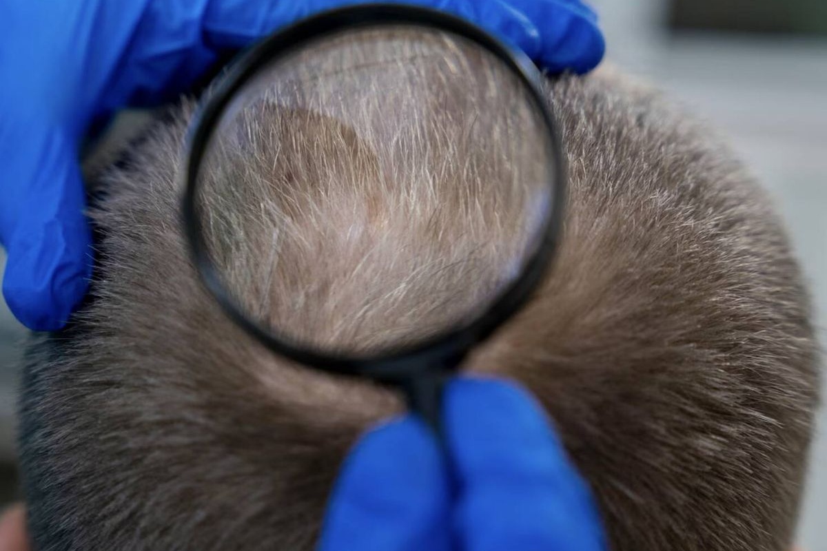 Japansko otkriće: Zašto sijeda kosa može biti znak da vaše tijelo radi savršeno