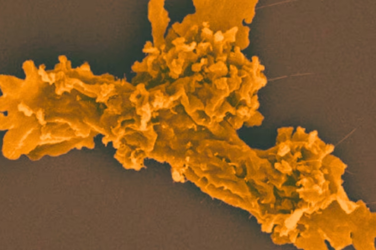 Nevjerojatno otkriće: Amoeba Incendiamoeba cascadensis prkosi granicama života u ekstremnim uvjetima!