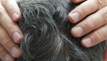 Čemu služi nanošenje sirćeta i sode bikarbone na sede i kako to pravilno uraditi