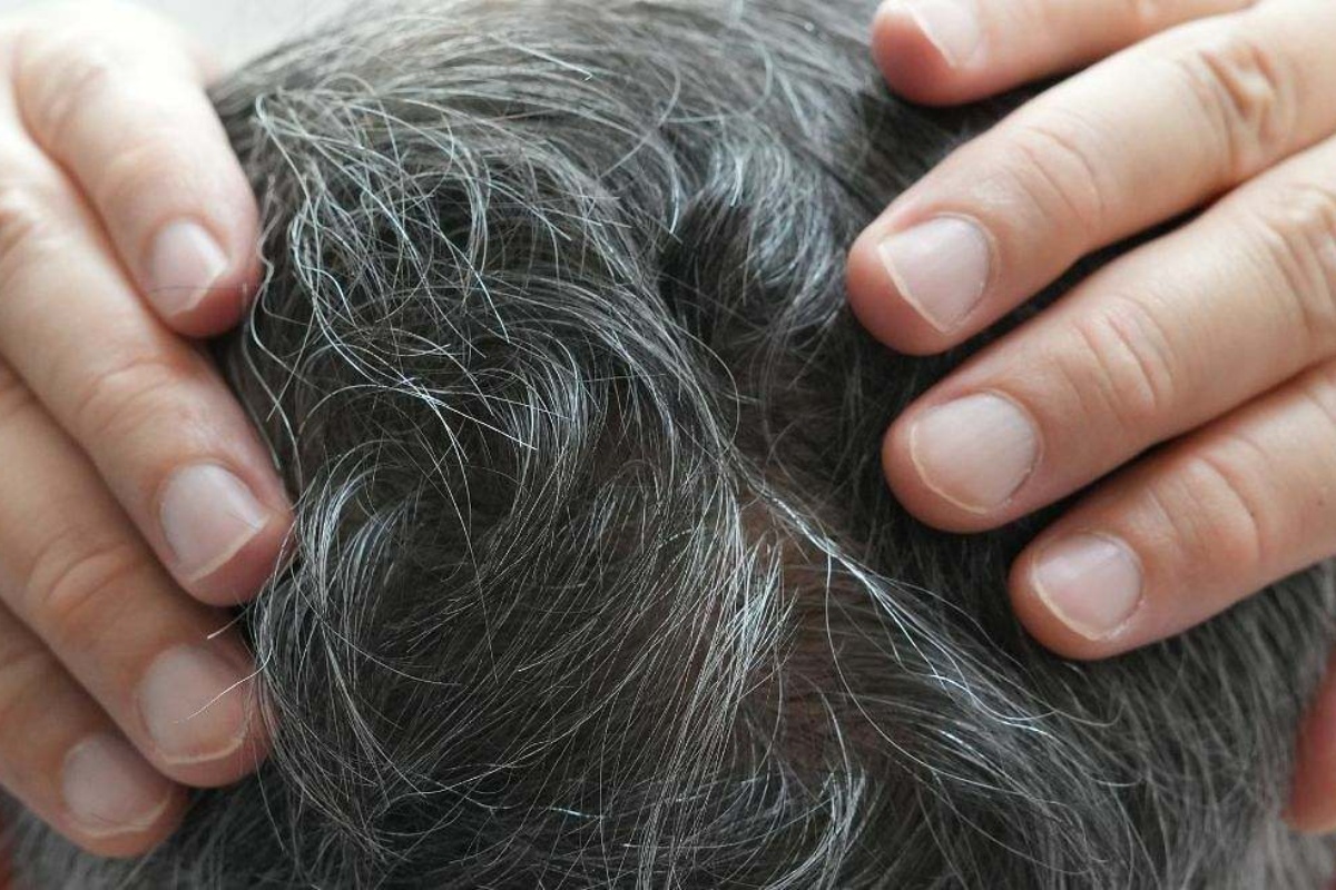 Čemu služi nanošenje sirćeta i sode bikarbone na sede i kako to pravilno uraditi