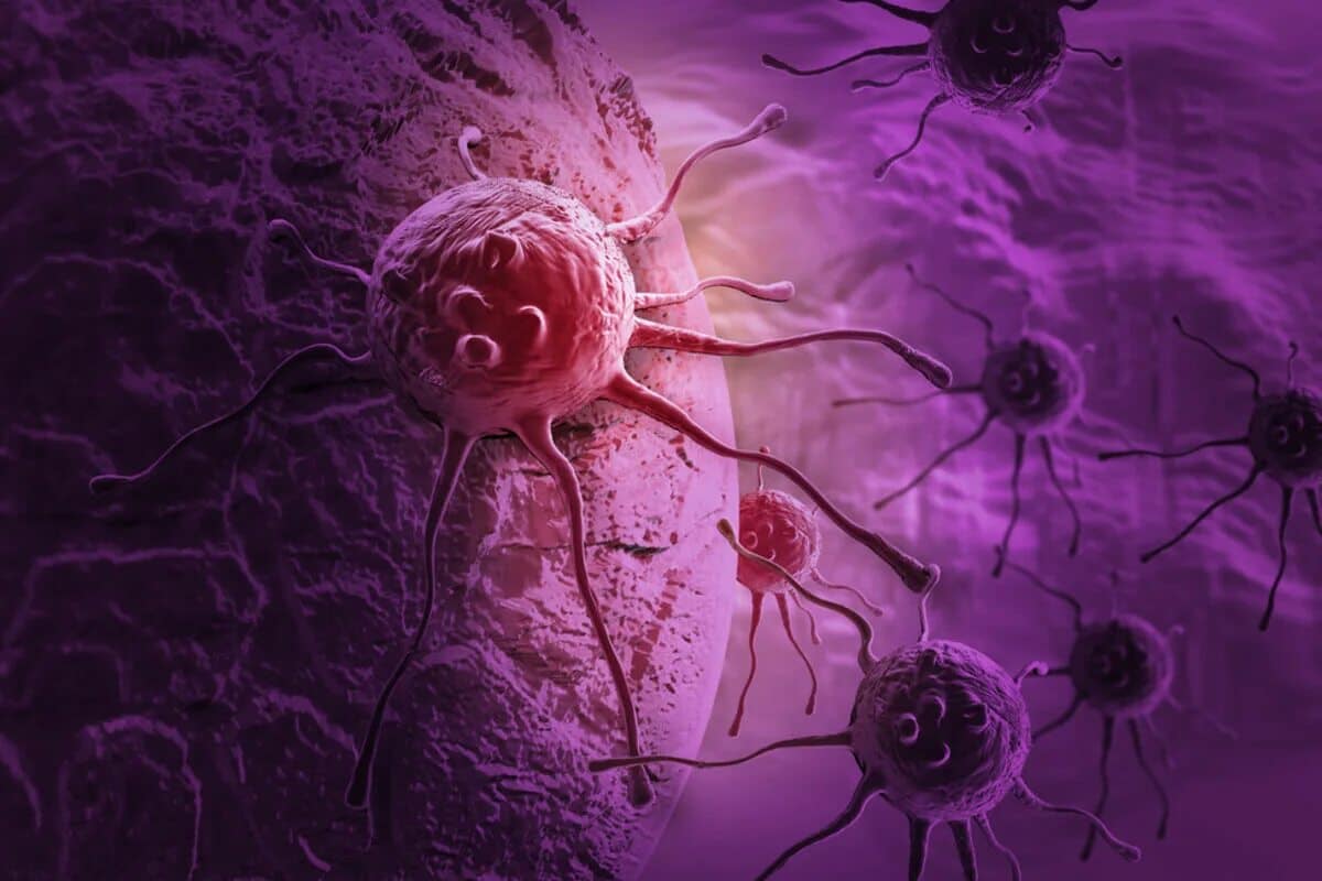 Som výživový poradca špecializujúci sa na onkológiu a tu sú tri návyky, ktoré odporúčam na zníženie rizika vzniku rakoviny.