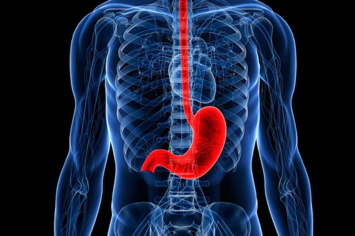 Od kiseline do tegoba: koji faktori narušavaju prirodnu barijeru želuca – image 2