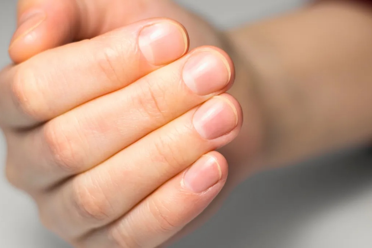 Jabukovo sirće i njegove prednosti: ultimativni saveznik za zdravlje noktiju – image 2