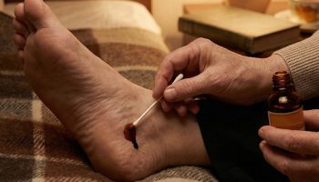 Zašto su naše bake trljale pete jodom prije spavanja: zaboravljena metoda koja djeluje bolje od modernih tableta