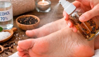 Prskanje stopala alkoholom i karanfilićem: Čemu služi i kada stručnjaci preporučuju ovaj tretman
